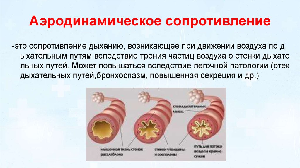 Аэродинамическое сопротивление. Аэродинамическое сопротивление дыхательных путей. Сопротивление аэродинамика. Донное сопротивление аэродинамика.