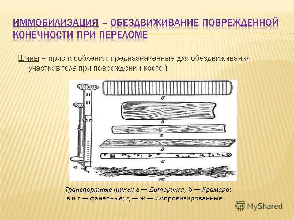 Шина краммера. Фанерная шина для иммобилизации. Виды транспортных шин. Шина Крамера и Дитерихса. Виды шин для иммобилизации.