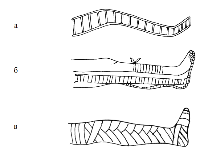 Стандартные средства иммобилизации. Шина Крамера при переломе голени. Табельные шины иммобилизации. Проволочная шина Крамера. Лестничная шина Крамера.